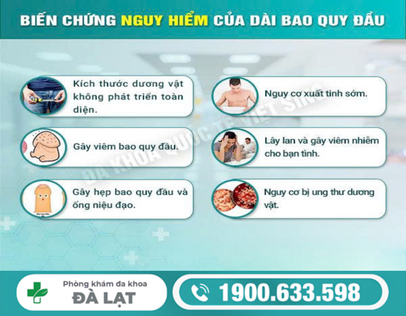Hình ảnh minh họa